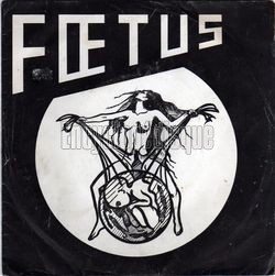 [Pochette de La radio l’a tu (FOETUS)]